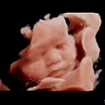 Best Pregnancy Ultrasound Service in Halifax